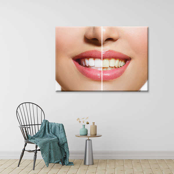 dental-office-wall-decor-1172-01 Diş Beyazlatma Öncesi ve Sonrası Temalı Kanvas Duvar Tablosu – 1172