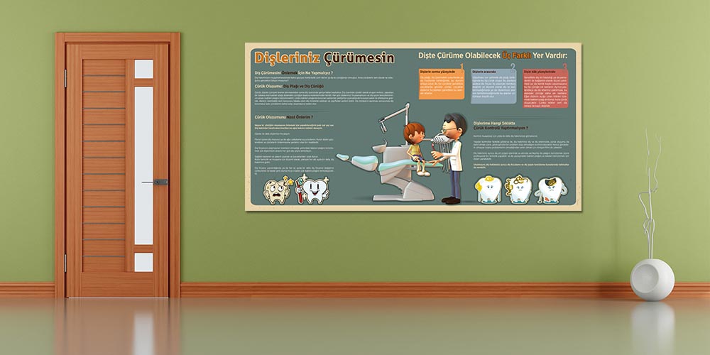 Diş Çürüğü Önleme Duvar Dekoru – Klinikler İçin Eğitici Büyük Ebatlı Baskı – 1198