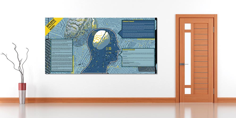 Epilepsi Bilgilendirme Büyük Ebat Poster  1232