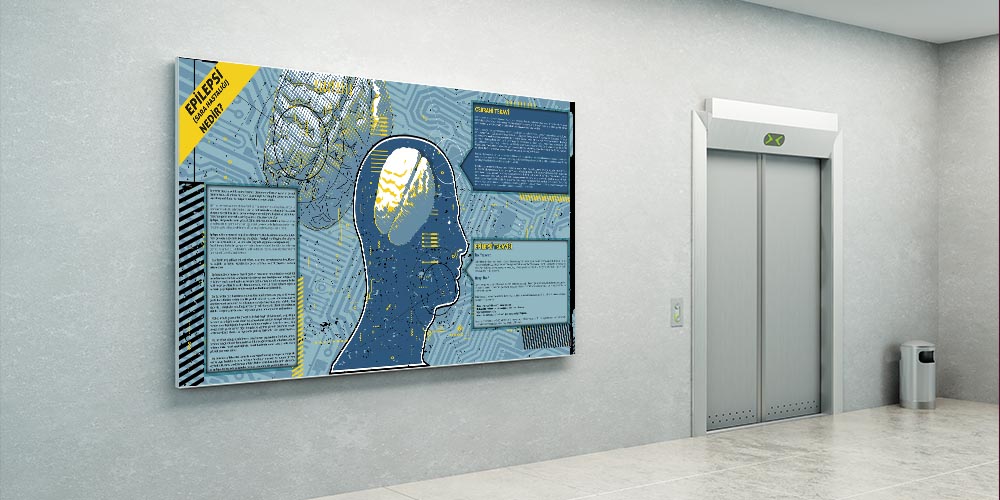 Epilepsi Bilgilendirme Büyük Ebat Poster  1232