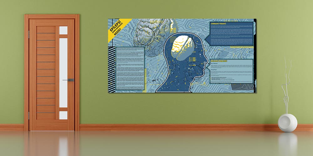 Epilepsi Bilgilendirme Büyük Ebat Poster  1232