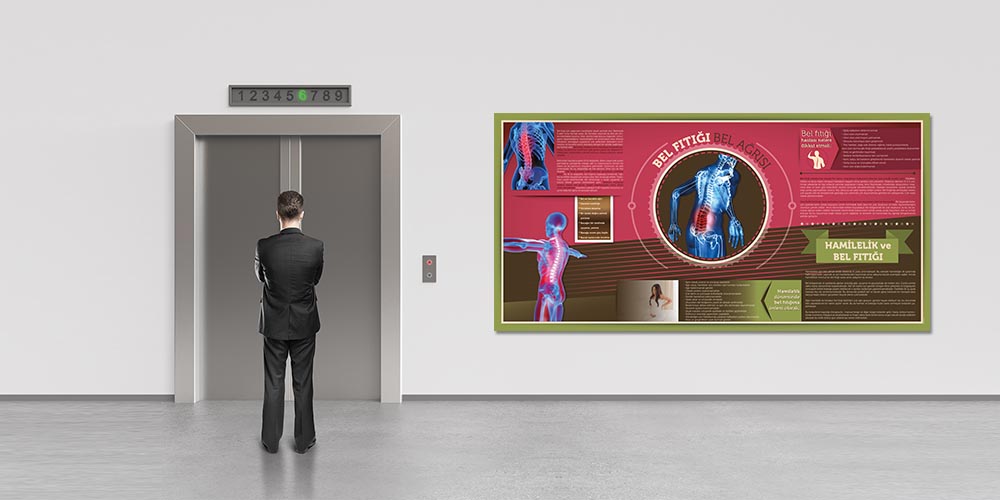 Bel Fıtığı Bilgilendirme Büyük Ebat Poster  1228