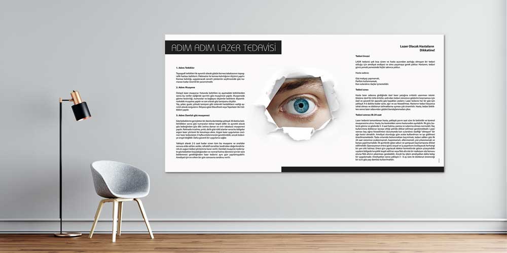 Adım Adım Lazer Tedavisi Bilgilendirme Panosu 1514