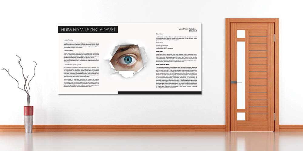 Adım Adım Lazer Tedavisi Bilgilendirme Panosu 1514