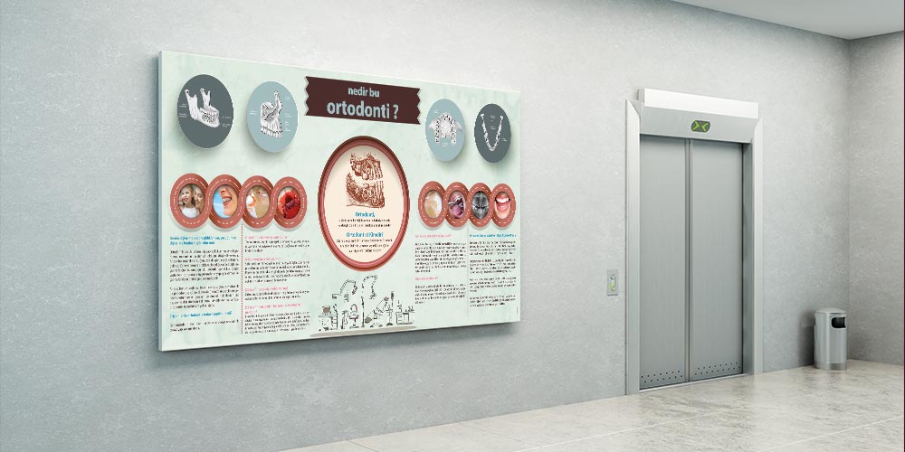 Ortodonti Nedir Duvar Dekoru – Büyük Ebatlı Dekoratif Baskı – 1199